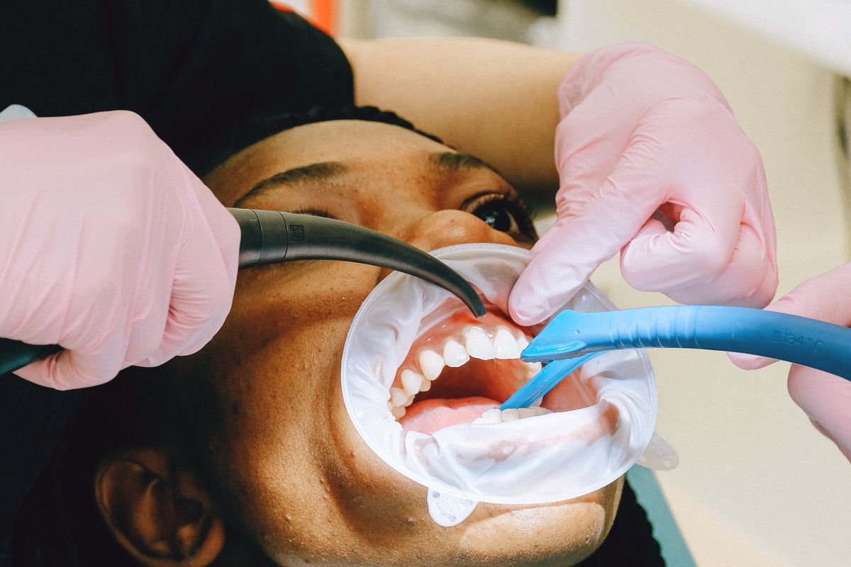 Bleeding gums while flossing